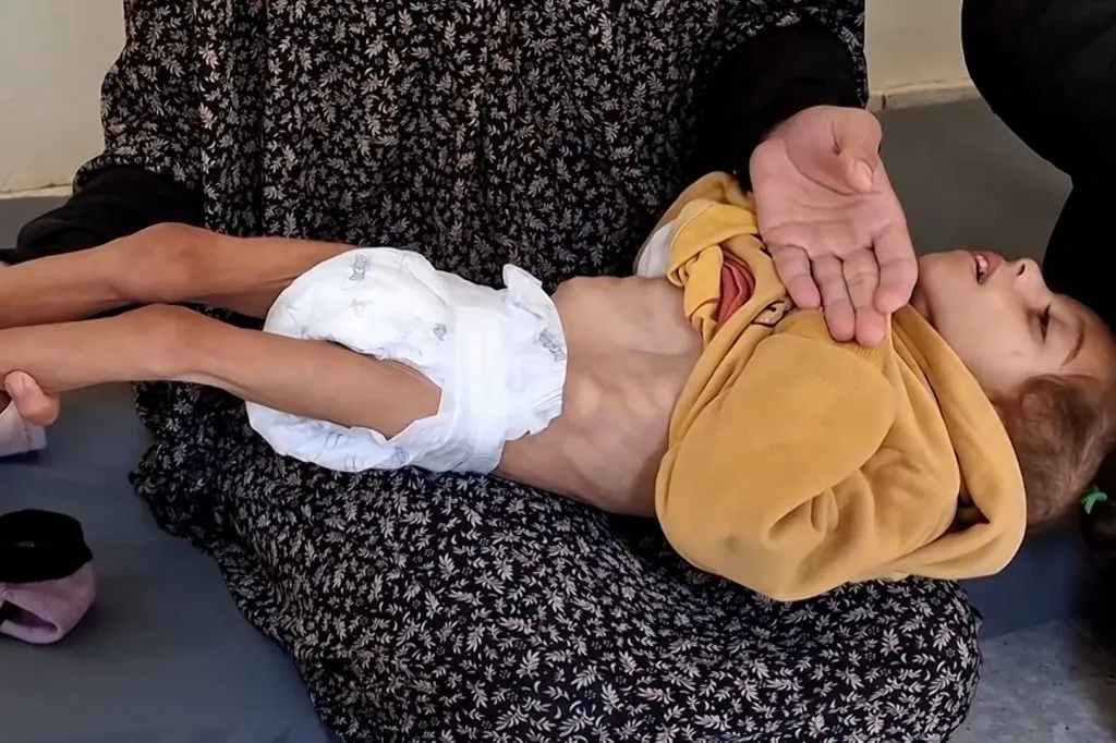 مأساة غزة: 60 طفلا استُشهدوا بسبب الجوع
