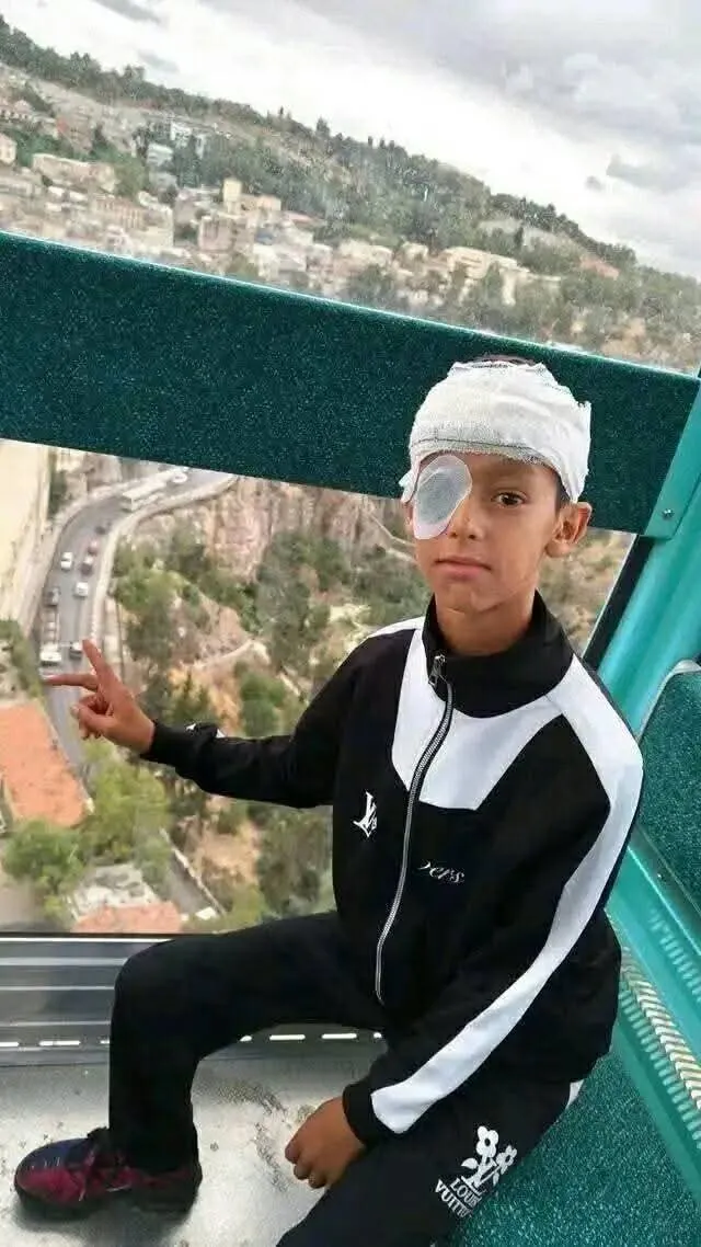 وفاة طفل بعد تعرضه لعضة كلب بأم البواقي وتشكيل خلية لمتابعة الوضع