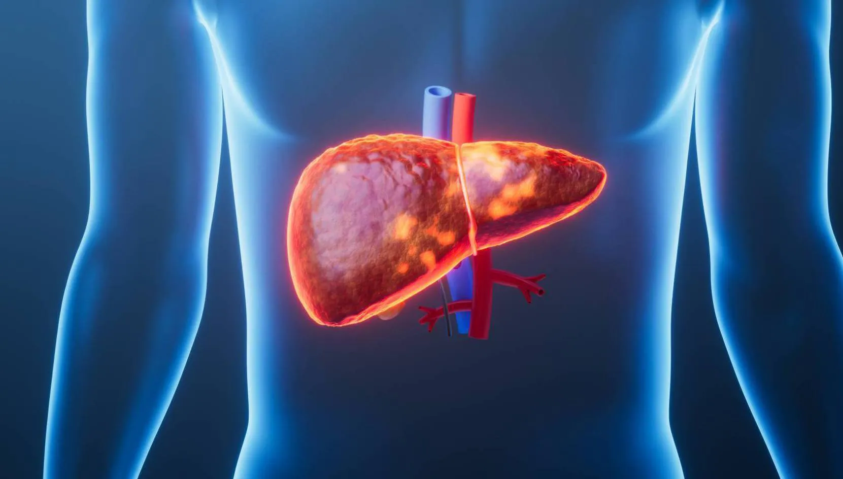 مركب طبيعي يجنب الكبد الكثير من الأمراض