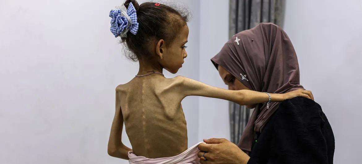 الأمم المتحدة تعلن رسميا تفشي المجاعة بغزة