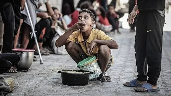 اليونيسف: أكثر من 10 آلاف طفل في غزة بحاجة لعلاج من سوء التغذية الحاد